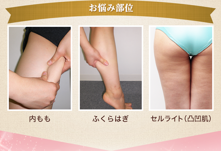 お悩み部位 内もも・ふくらはぎ・セルライト(凸凹肌)